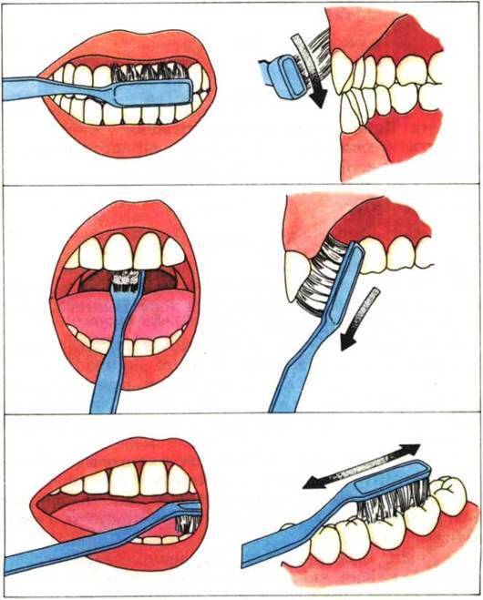Мотивация чистки зубов