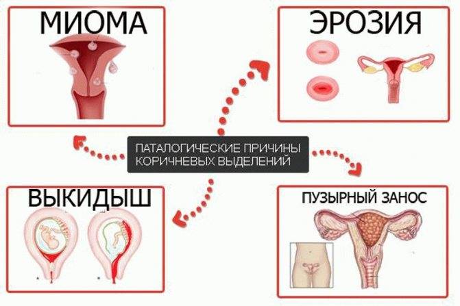 Кровянистые выделения у женщин: нормы, причины патологий
