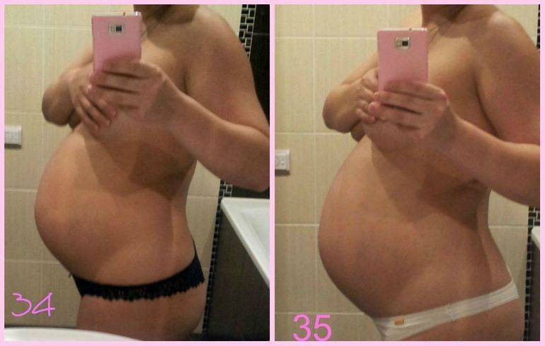 37 неделя беременности: узи плода на 37 неделе