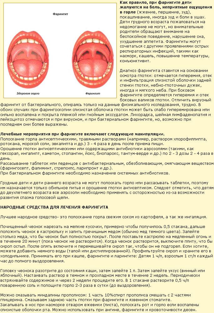 Симптомы грибковой ангины у детей и лечение инфекции противогрибковыми препаратами