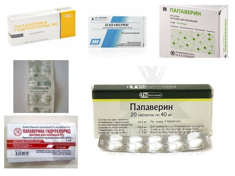 Кандидоз - симптомы, причины развития, лечение