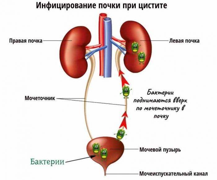 Топ-15 препаратов при цистите