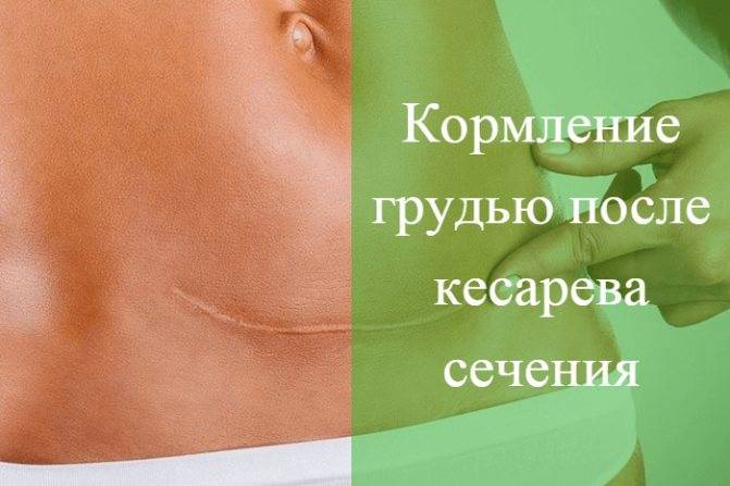 Азбука грудного вскармливания: кормление грудью после кесарева
