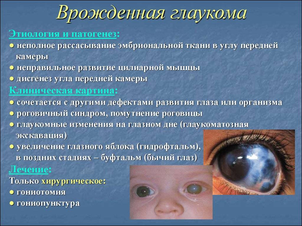 Профилактические мероприятия офтальмологических заболеваний у детей