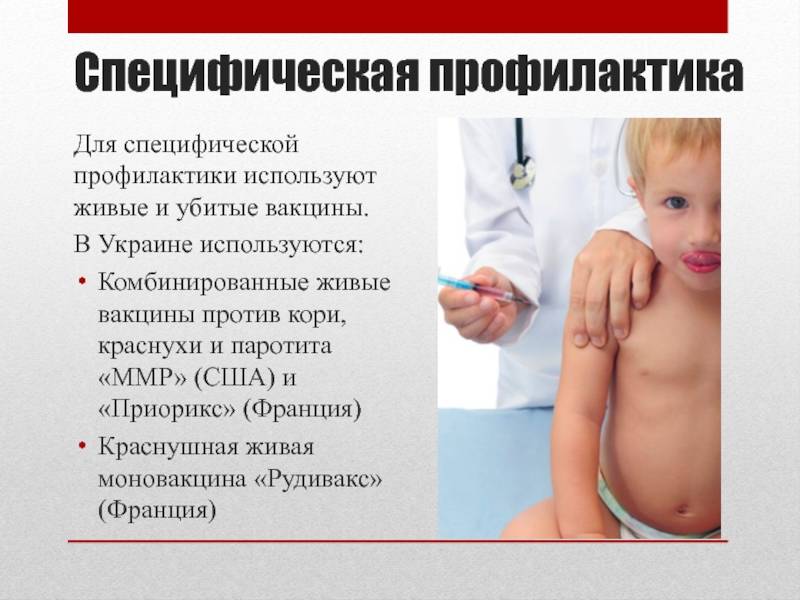 Корь: симптомы, профилактика, вакцинация – напоправку – напоправку