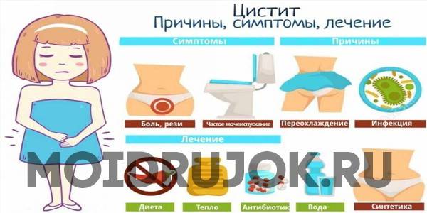Цистит - симптомы, причины развития, лечение