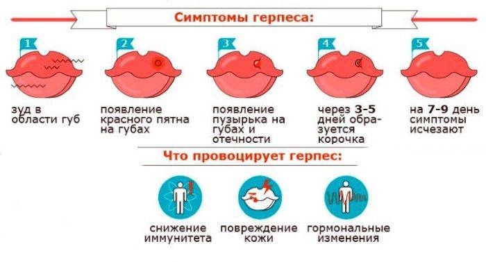 Врожденные вирусные инфекции