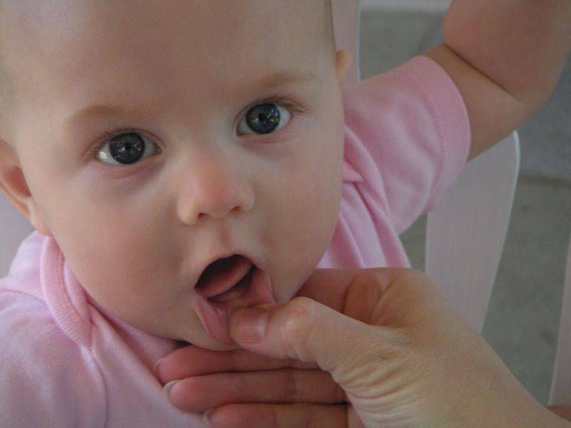 Анастезия при удалении молочного зуба: особенности детской анастезии