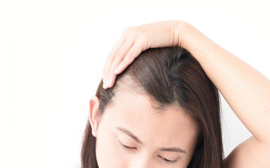 Сильное выпадение волос у женщин – причины, способы лечения волос