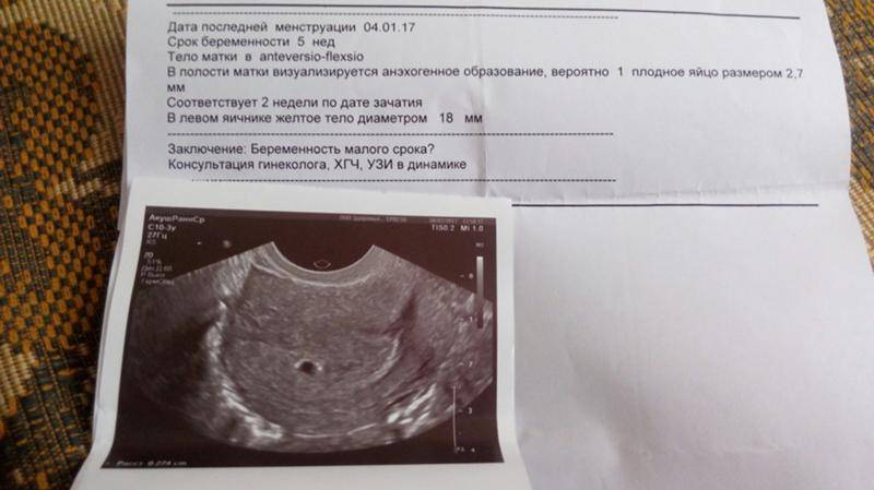 Признаки беременности и ранняя диагностика: все методы