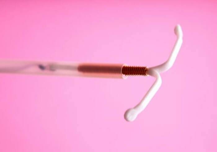 Удаление внутриматочного контрацептива (вмс)
