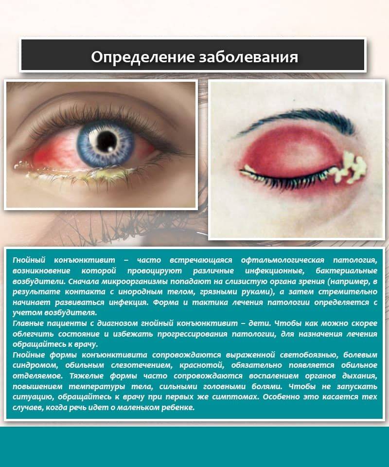 Глазные болезни у детей: виды, симптомы, причины, лечение