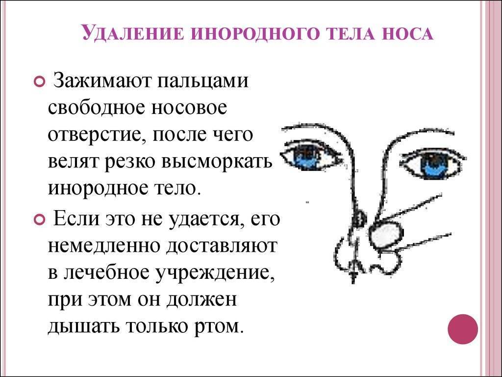 Инородное тело в носу у ребенка - что делать?