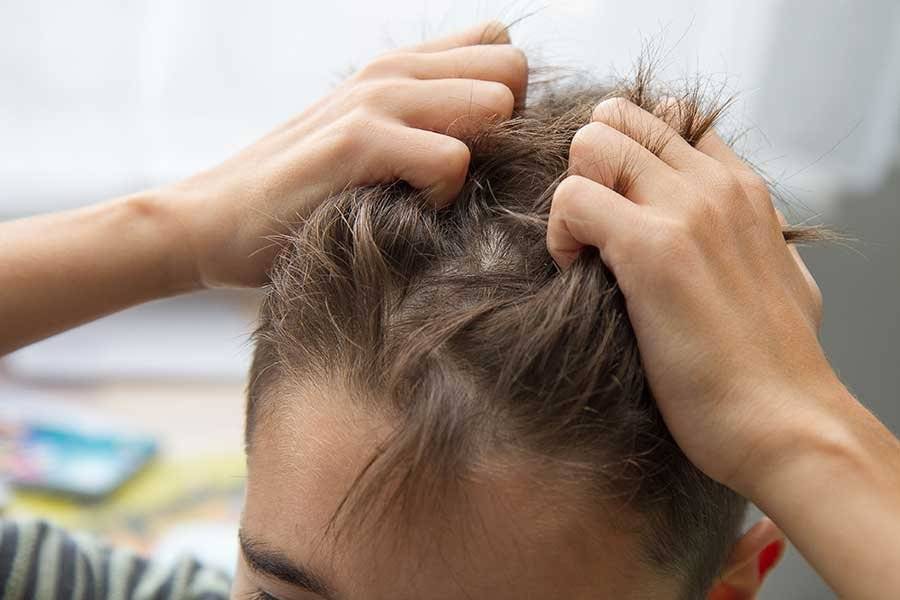 Что делать, если после выведения вшей чешется голова