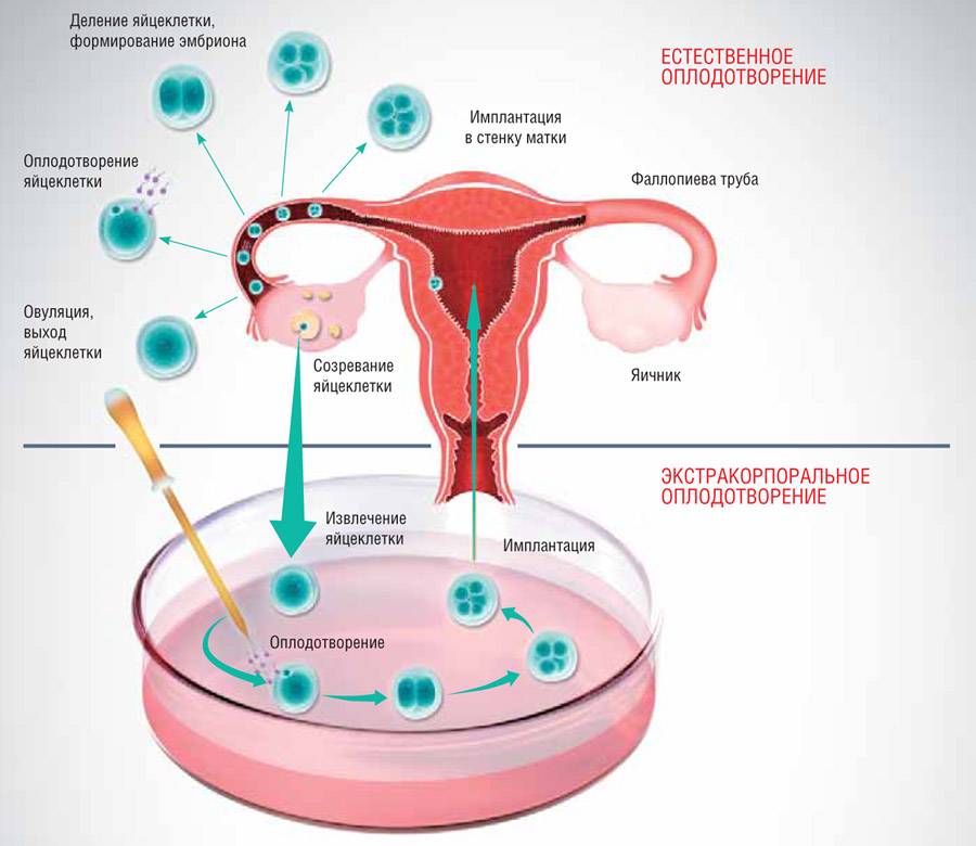 Овариальный резерв яичников — запас яйцеклеток ограничен