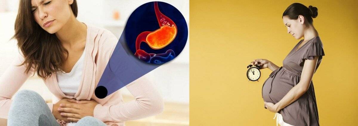 Причины и способы устранения изжоги во время беременности