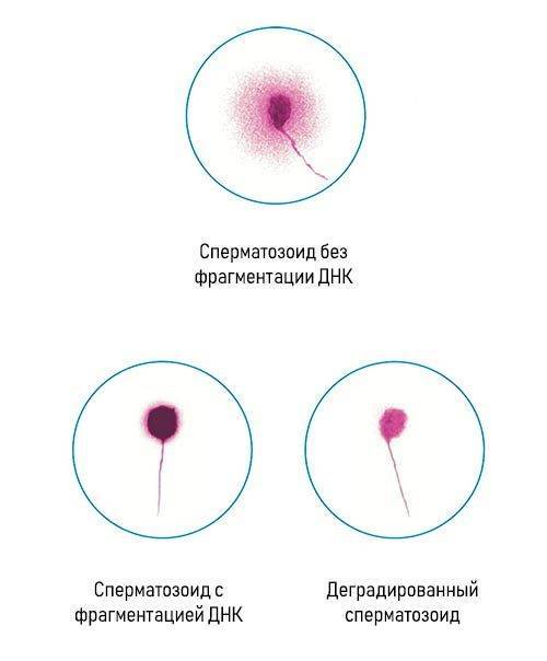 Фрагментация днк сперматозоида. целостность днк. анализ на фрагментацию днк в москве.