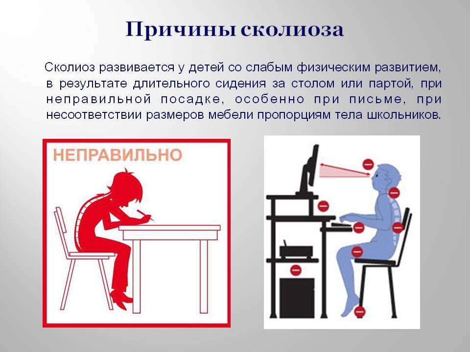Искривление позвоночника (сколиоз, кифоз, лордоз). лечение