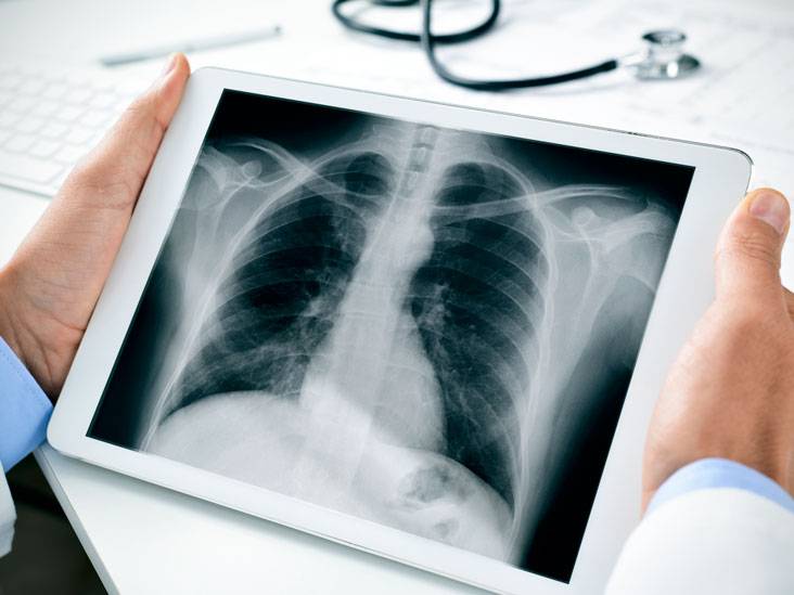 Рентген грудной клетки - цены в москве в клинике семейный доктор