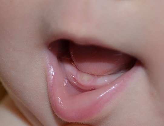 Зубы у детей: порядок прорезывания, признаки и сроки