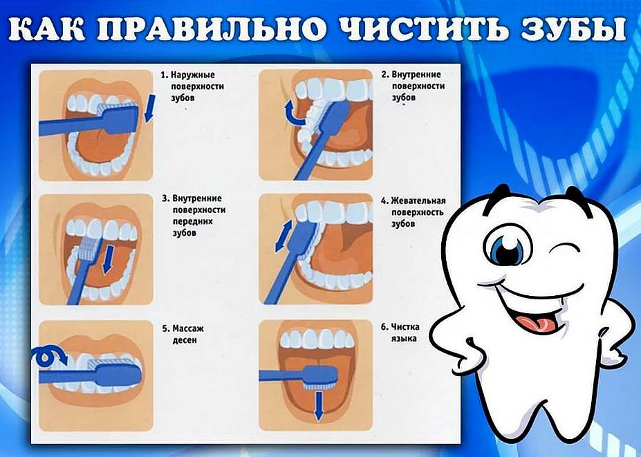 Как выработать привычку чистить зубы?