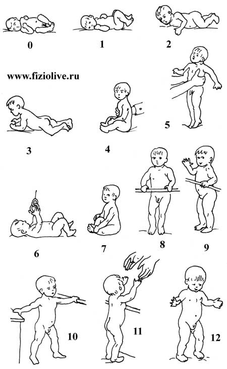 Кривошея у новорожденных: признаки, причины, лечение, массаж, фото