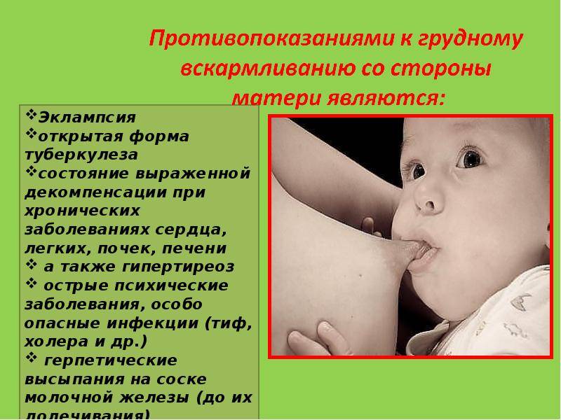 Кариес у детей: лечение, кариес молочных зубов, фото, симптомы, диагностика