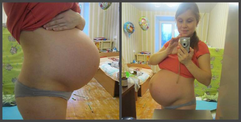 Часто каменеет живот на 37 неделе - для беременных
