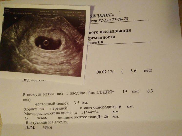 Некоторые этапы развития эмбриона