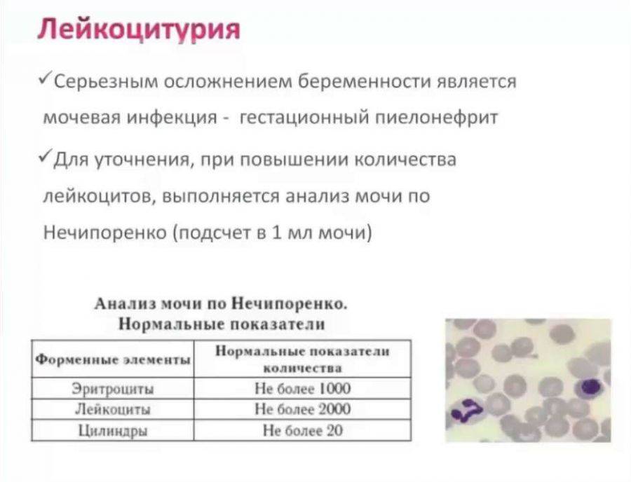 Повышенные лейкоциты в крови и лейкоциты в моче - что это значит? * клиника диана в санкт-петербурге