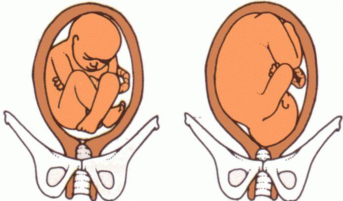 До какой недели беременности малыш может переворачиваться и когда малыш должен перевернуться перед родами