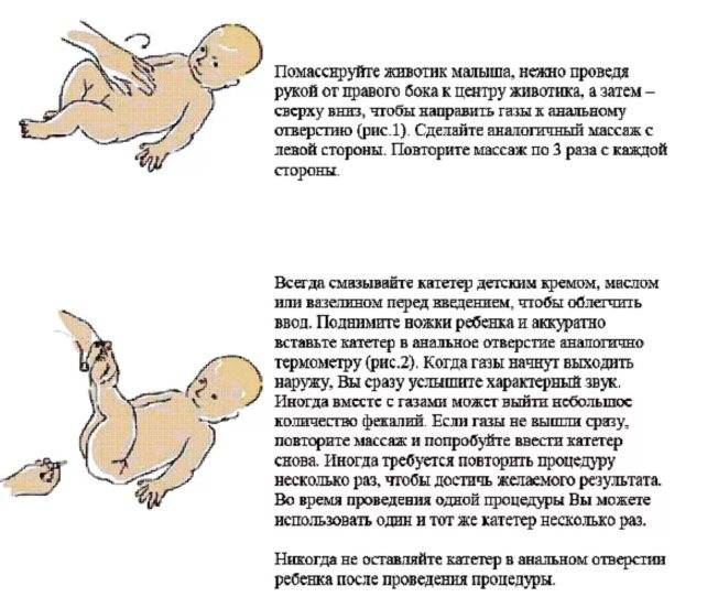 Газики у новорожденных при грудном вскармливании: что делать при повышенном газообразовании?