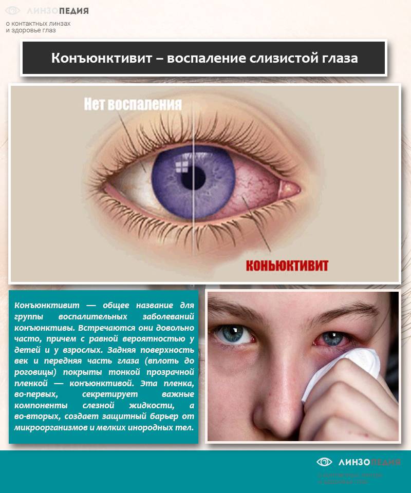 Как лечить легкие травмы глаз — новости и публикации — pharmedu.ru