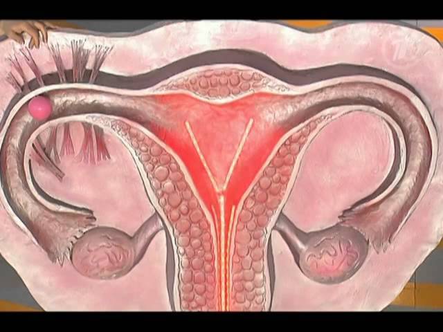 Боли в пояснице перед менструацией | москва