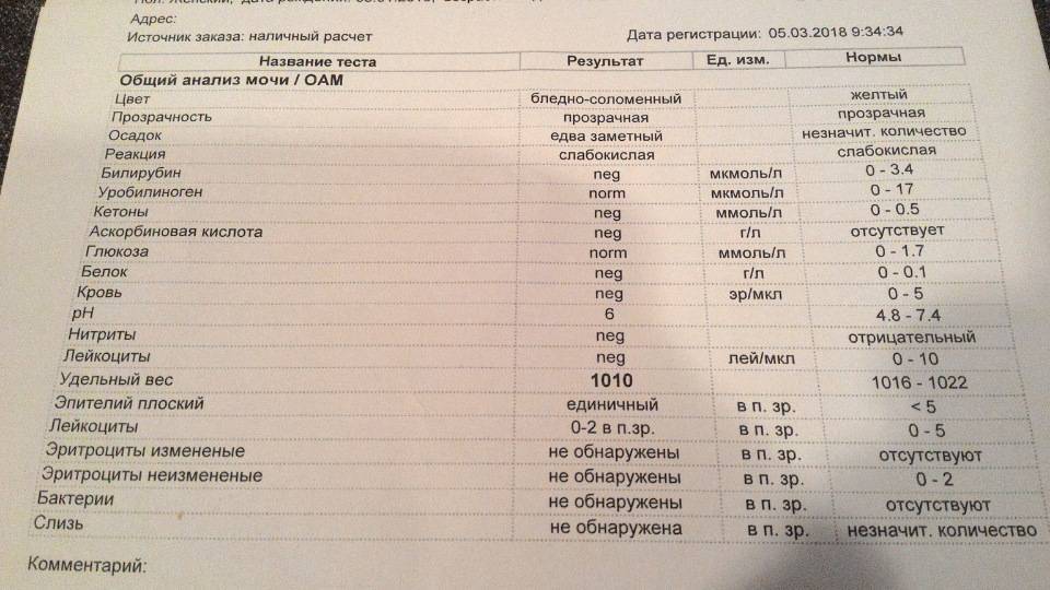 Расшифровка анализа мочи общий. Общий анализ мочи показатели нормы. Анализ мочи Результаты норма расшифровка. Норма показателей общего анализа мочи у мужчин таблица. Общий анализ мочи норма таблица.