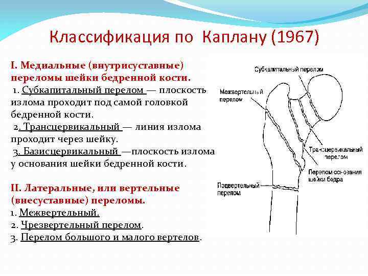 Компрессионный перелом позвоночника у детей