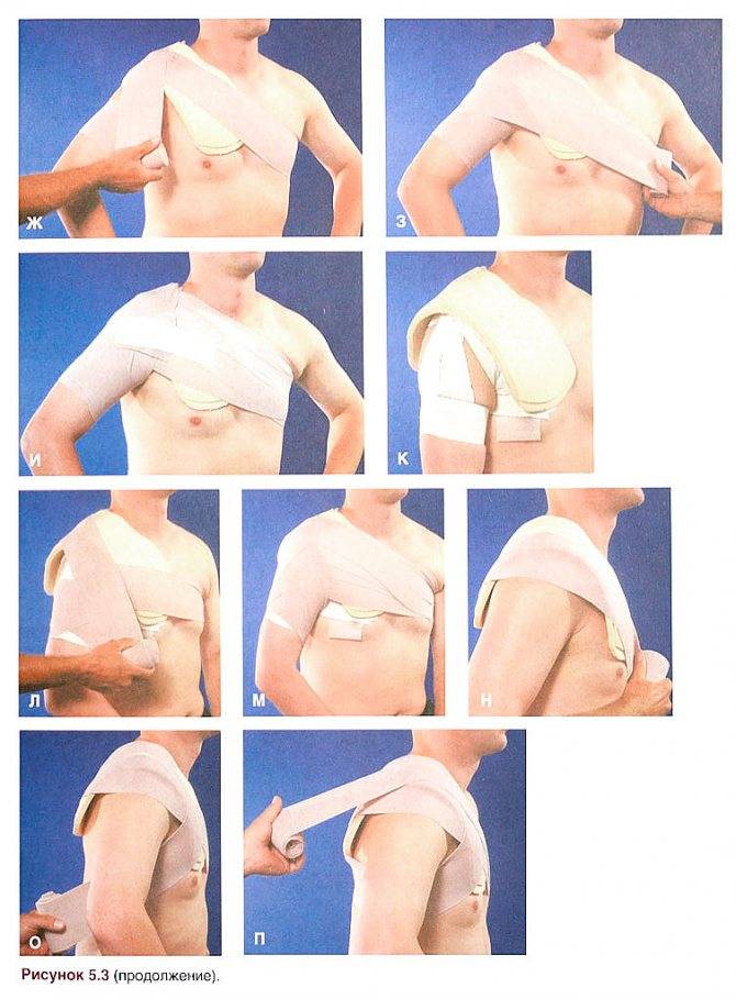 Как перетянуть грудное молоко (перевязать грудь) для предотвращения лактации: фото | опыт | vpolozhenii.com