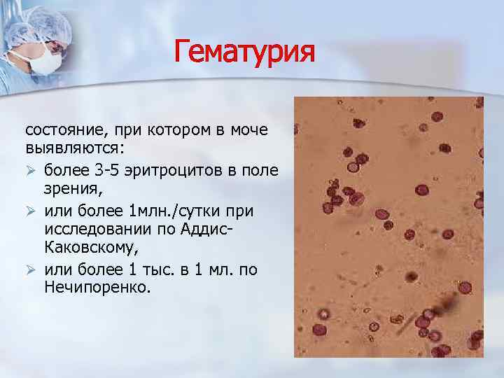 Кровь в моче (гематурия) у женщины, у мужчины.