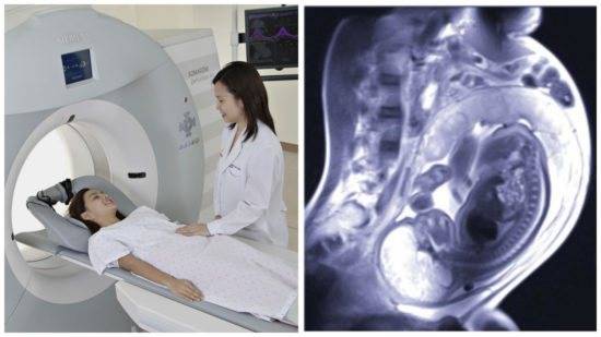 Можно ли делать МРТ беременным на ранних и поздних сроках: томография головного мозга, позвоночника
