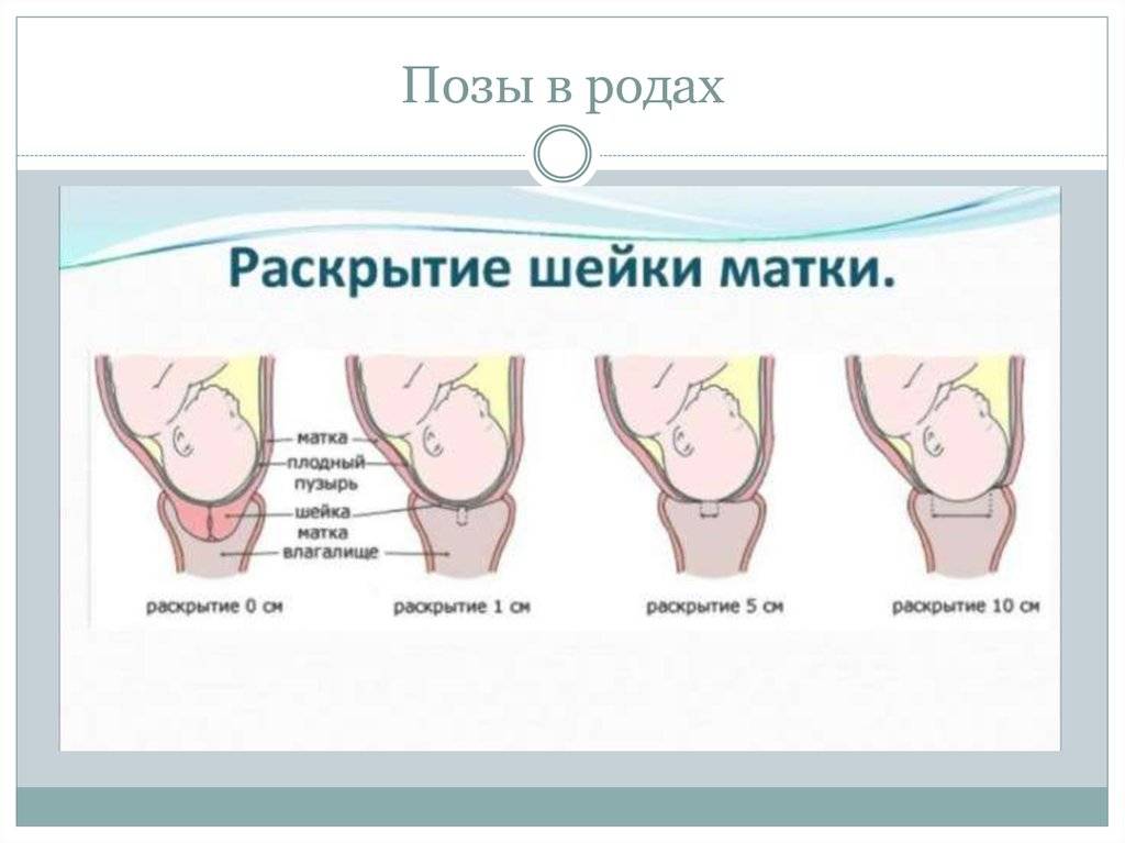 Раскрытие шейки матки перед родами: на 1, 2 пальца, катетер фолея и ламинарии | merilin-clinic.ru