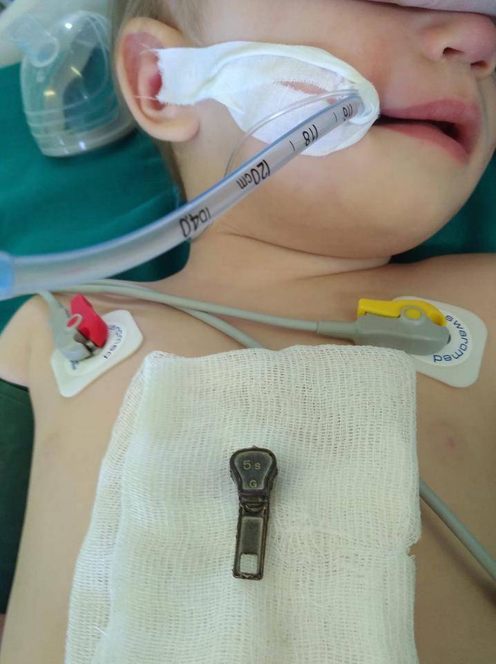 Ребенок проглотил батарейку таблетку: что делать и как помочь?
