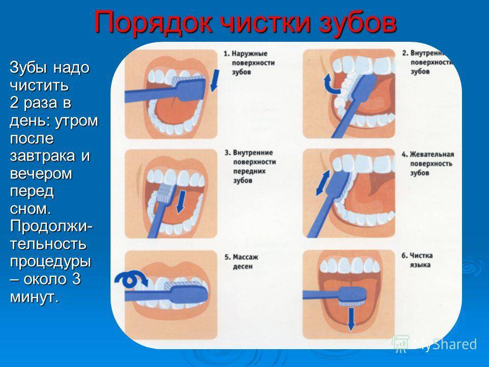 Как правильно чистить зубы в домашних условиях - ortodonts.ru