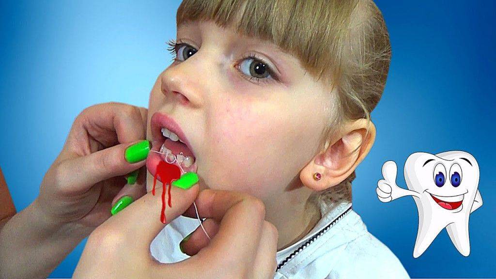 Как быстро вырвать молочный зуб ребенку дома без боли