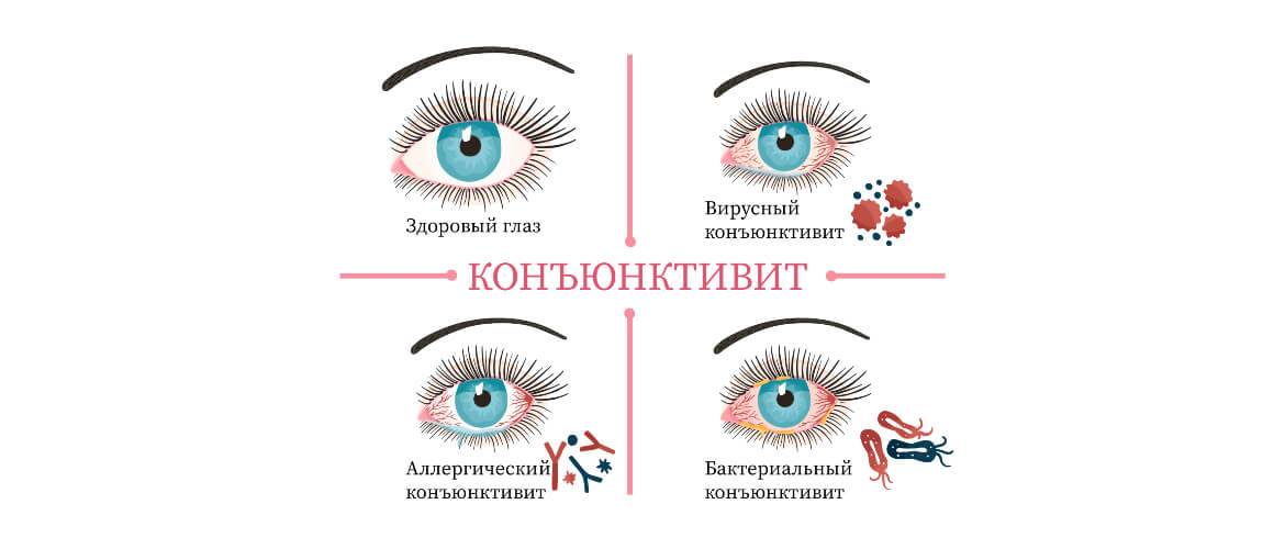 Как выбрать пробиотики для кишечника: список препаратов