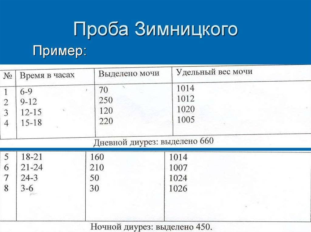 Направление на мочу по зимницкому образец