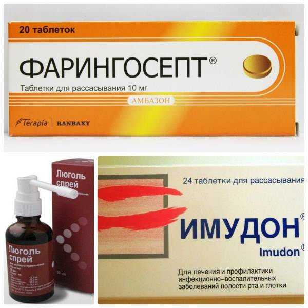 Ларингит