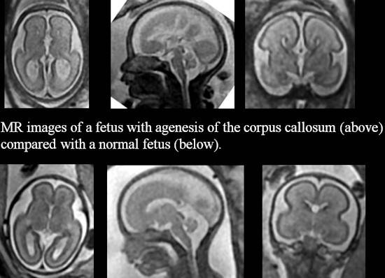 Компьютерная томография (кт, мскт) в новосибирске – цены на томографию головного мозга, брюшной полости, грудной клетки