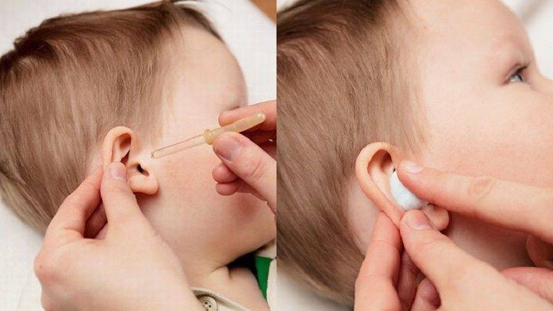 Отит уха у ребенка, что делать при воспалении уха у детей
