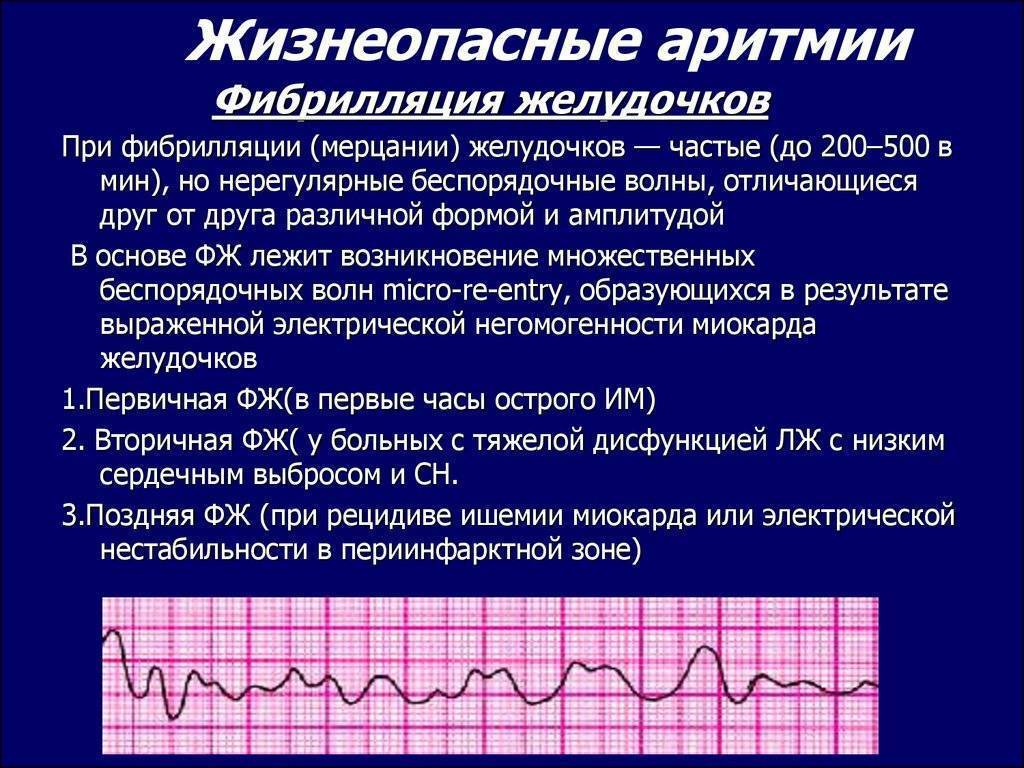 Нарушения сердечного ритма | кардиологический центр в санкт-петербурге