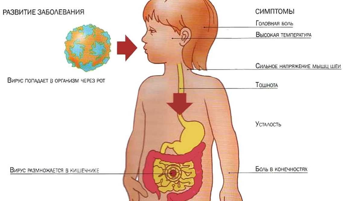 Симптомы коронавируса: первые признаки - как распознать covid-19 - причины, диагностика и лечение
